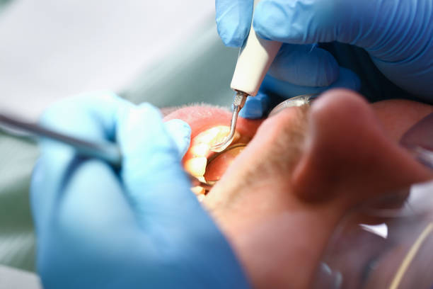Best Weekend Emergency Dentist in China Grove, NC